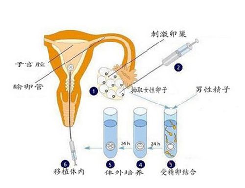 供卵去哪里做比较好【供卵去哪里做比较好?选择最佳供卵地点的指南】