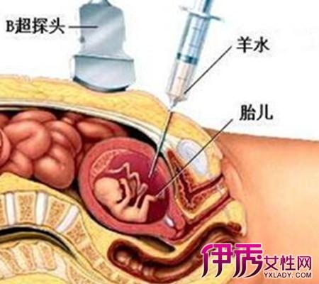 供卵生子的风险(供卵生子风险揭秘:你需要知道的重要事项)
